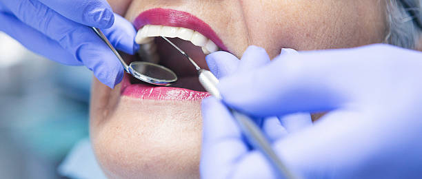 Best Emergency Dental Extractions in Morro Bay, CA